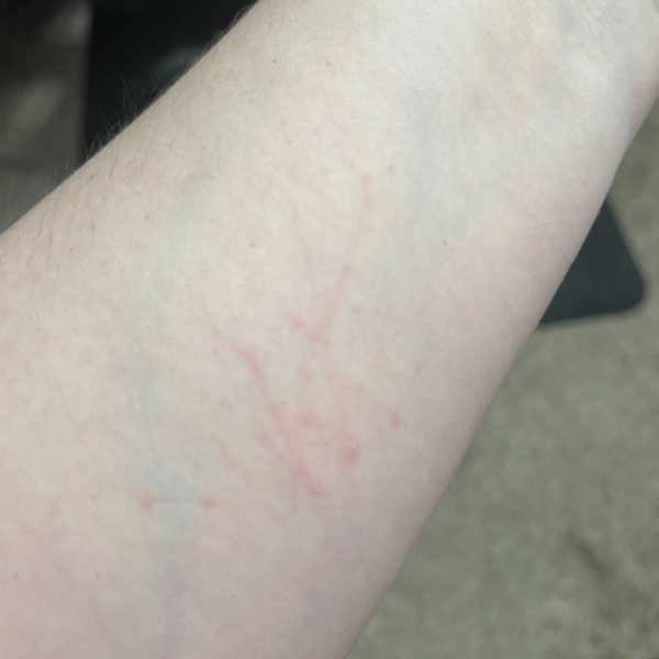 Pink scratch marks on Kayla's arm from demo-ing resin daggers for less than three minutes.